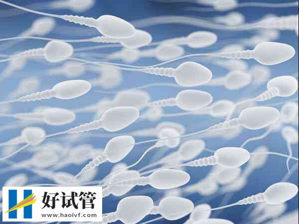 什么是白细胞精子症(图1) 精液中白细胞增多有多种原因