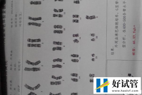 谁说取卵后医生不会发告知胚胎质量的短信,咋样看完就造(图3) 染色体异常胚胎质量差