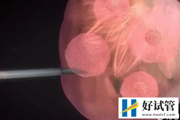 谁说取卵后医生不会发告知胚胎质量的短信,咋样看完就造(图1) 取卵后医生会发告知患者