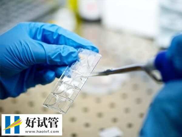 移植后哪些原因造成孕酮低(图1) 内分泌异常是导致移植后孕酮低的原因之一