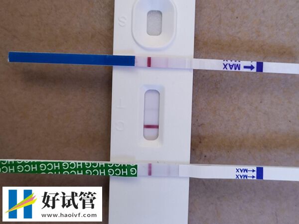 郴州市第一人民医院人工受孕好吗?着床率竟这么高(图2) 郴州市第一人民医院生殖科如何