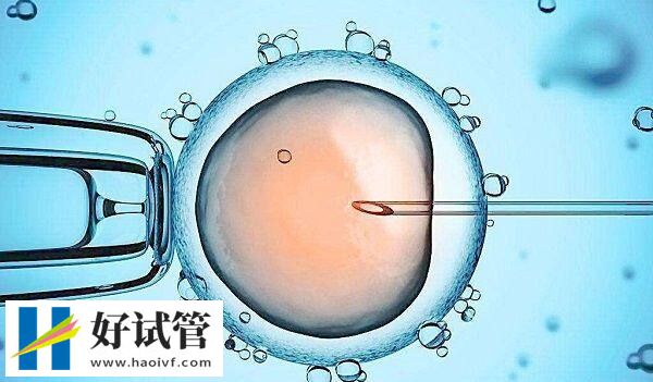 秦皇岛试管婴儿有哪些(图1) 秦皇岛试管婴儿医生多