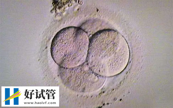 做试管婴儿生的宝宝一般能活几年(图1) 生活习惯会影响试管婴儿寿命