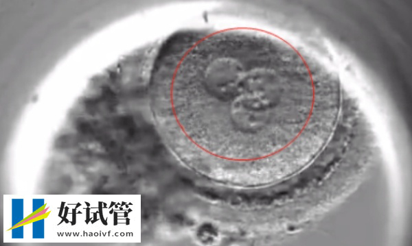 做试管婴儿生的宝宝一般能活几年(图3) 首例试管婴儿活了46岁