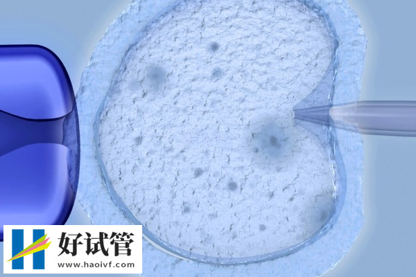 做试管婴儿攒胚胎和养囊胚胎区别是什么(图1) 养囊后移植妊娠率更高