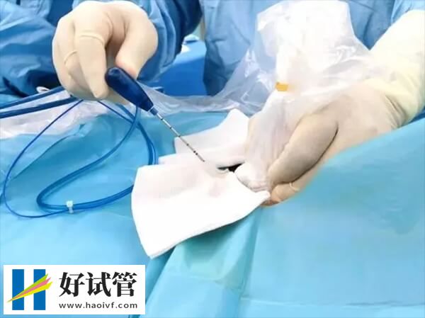 胚胎移植前做宫腔灌注好不好(图1) 月经期间不能宫腔灌注