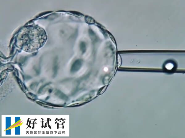 试管婴儿第几代比较好(图1) 二代试管婴儿采用单精子注射技术