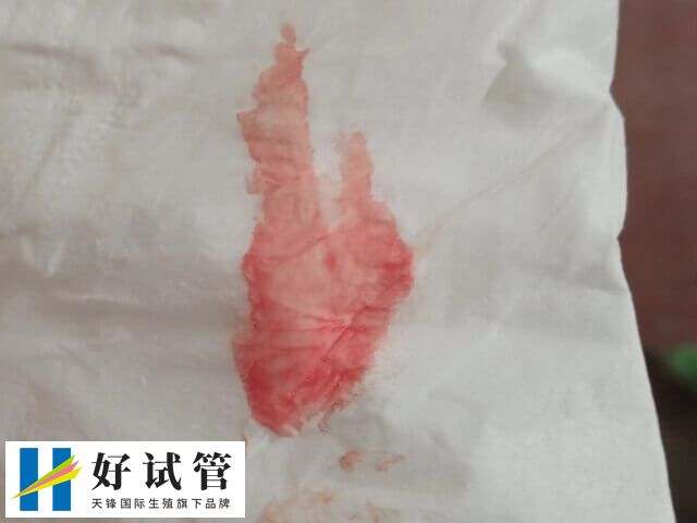 胚胎移植着床出血是什么颜色(图1) 胚胎移植后着床出血的量少