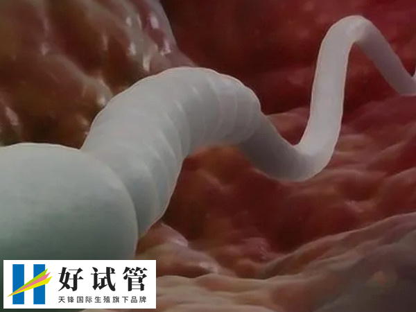 人工助孕生男孩还是女孩是由什么决定的(图1) 生男生女取决于精子