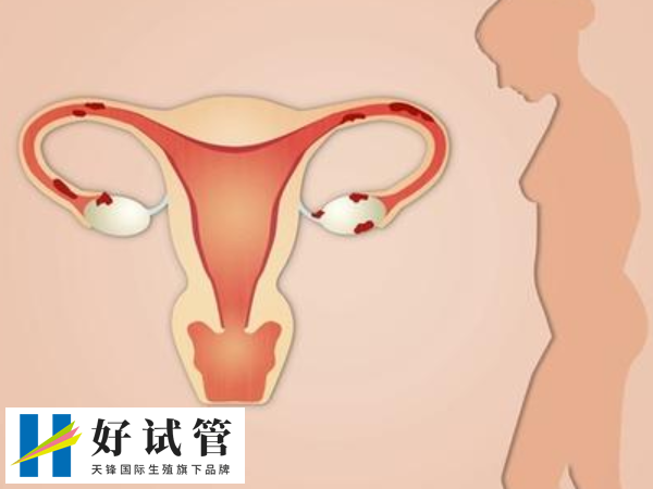 女性供卵自怀对母体的要求有哪些(图1) 供卵自怀对子宫内膜厚度有要求