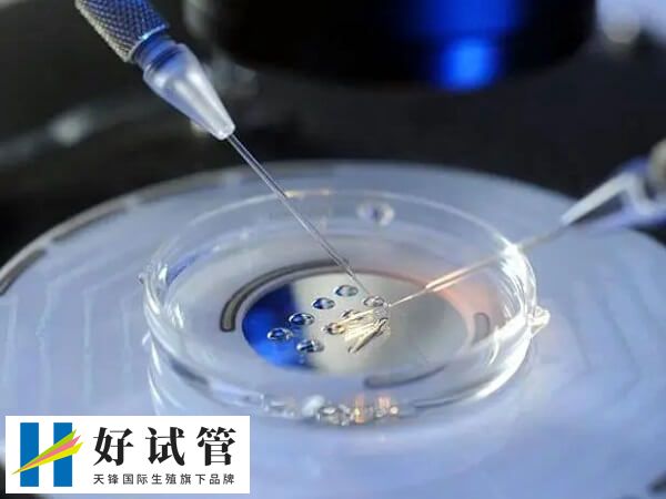 移植两个鲜胚能不能怀龙凤胎(图2) 移植胚胎的质量好可提高龙凤胎生育几率