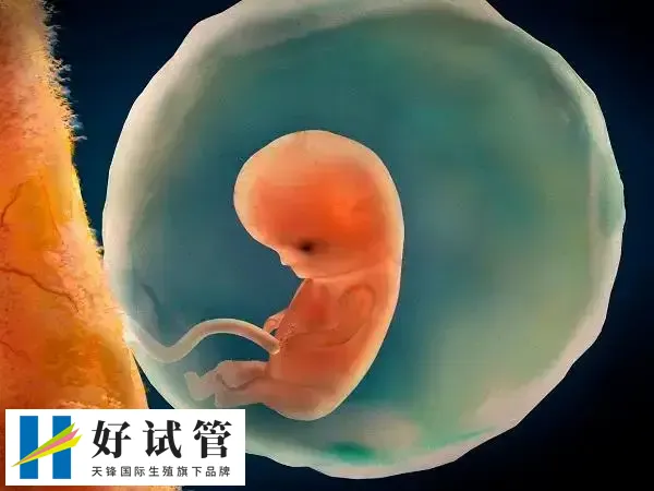 试管婴儿费用高不高(图3) 二代试管婴儿大约在4-6万元