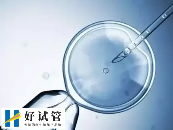 格鲁吉亚试管技术好不好(图1) 格鲁吉亚试管技术比较不错