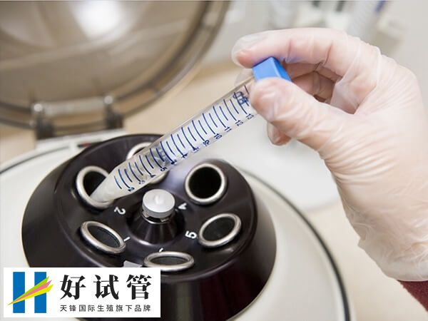 试管婴儿胚胎移植手术疼不疼(图2) 胚胎移植过程大约5-15分钟左右