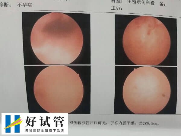 宫腔粘连手术后移植胚胎能否成功(图1) 宫腔粘连需要手术治疗