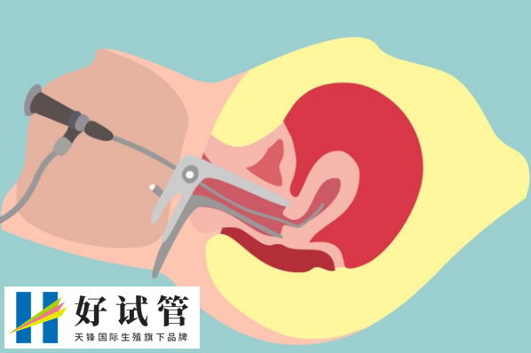 上海市不孕不育医院做试管婴儿一般得多钱?哪家医院成功率最高?(图1) 上海市不孕不育医院做试管婴儿一般得多钱?哪家医院成功率最高?(图1)