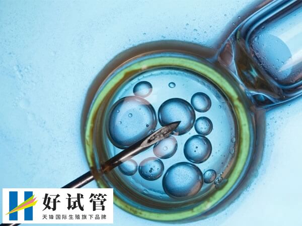 试管婴儿移植后宫外孕几率大不大(图2) 试管移植出现宫外孕的概率是比较小的
