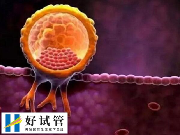 子宫息肉影不影响胚胎着床(图2) 内膜的厚度达到8-15mm左右可移植胚胎