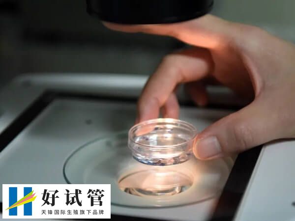 杭州邵逸夫做试管多少钱(图2) 促排卵用药不同收费价格不同