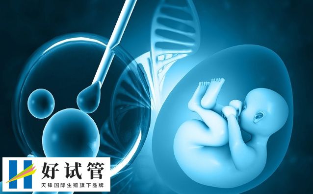 试管专家 试管专家