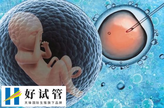 试管婴儿 试管婴儿