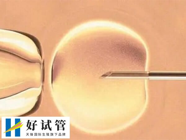 日本英医院试管收费多少(图2) 受精卵培养基本费用为5万日元