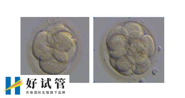 试管婴儿优胚和普胚的区别有哪里(图1) 优质胚胎和普通胚胎