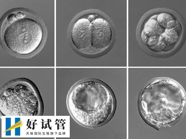 50岁绝经了怎么做试管(图1) 自然绝经的卵巢内卵泡所剩无几