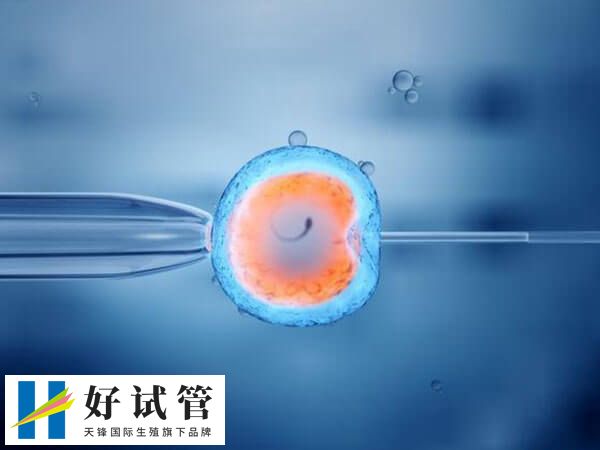 第四代试管技术有什么优势(图2) 卵子干细胞技术能提高卵子质量