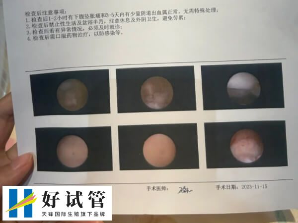 宫腔镜检查是一种现代医学手段