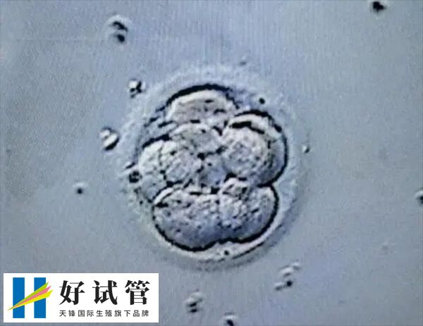 胚胎着床成功排出白带是怎样的(图2) 胚胎着床成功的白带颜色为无色透明