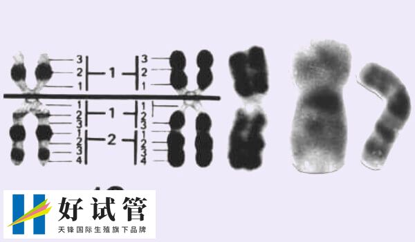 无创DNA提示胎儿16号染色体偏多还能留下吗?(图1) 无创提示16号染色体数目偏多不建议留