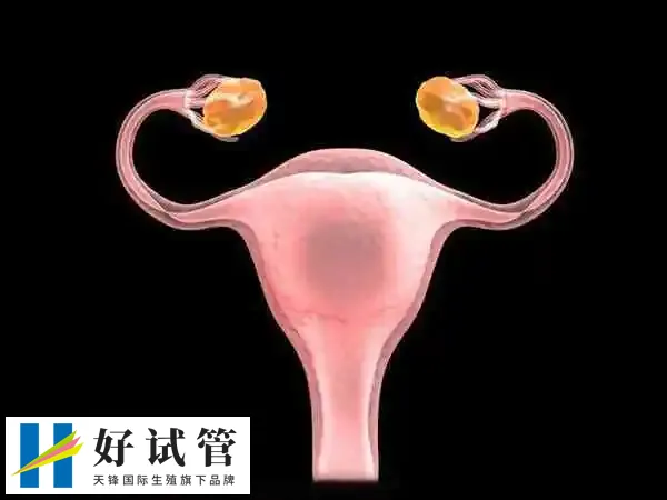 宫腔粘连做试管婴儿是否有影响(图1) 宫腔粘连可能导致子宫内膜发育不良