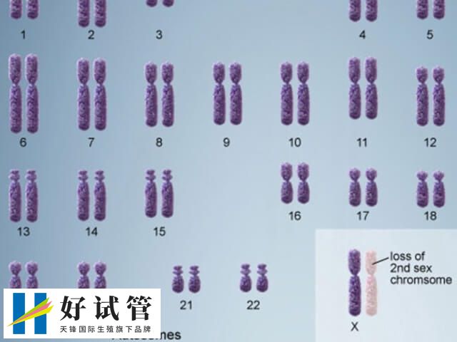染色体缺失做试管要多少钱(图1) 1.jpg