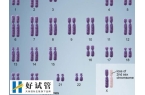 染色体缺失做试管要多少钱